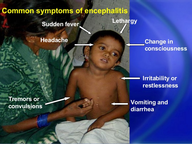 long-term-complication-of-herpes-simplex